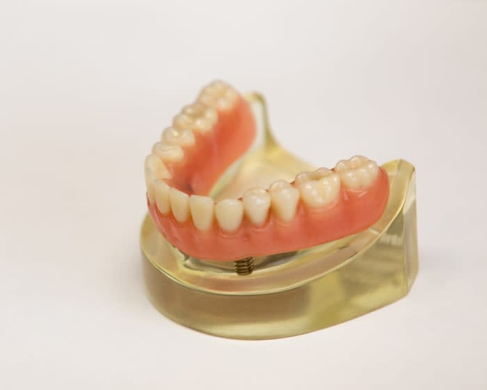 Prothèses dentaires | Clinique Dentaire Dr. S. Sgro & Dr. J. Lang | Greenfield Park, Montreal Dentist